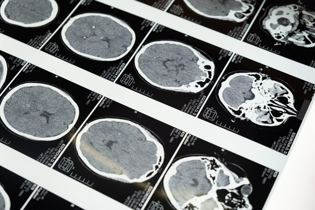 How Artificial Intelligence Will Transform Medical Imaging