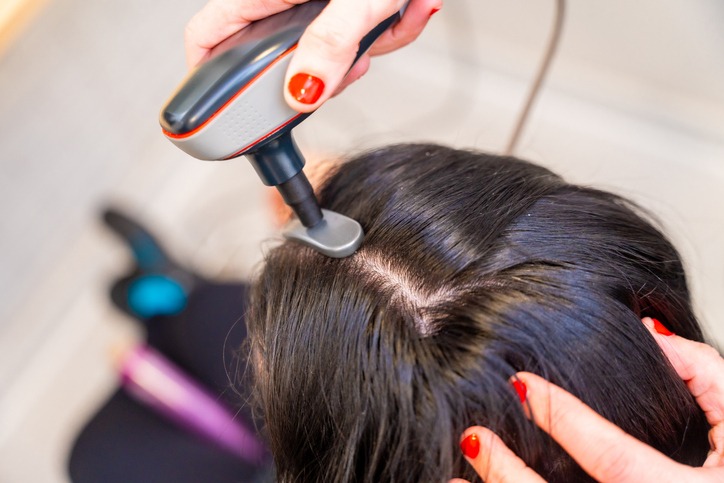 Why Tampa is a Hub for Innovative Hair Replacement Techniques